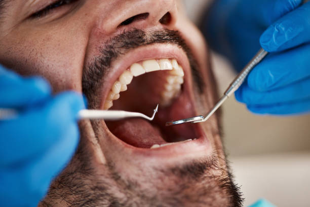 Best Knocked-Out Tooth Emergency  in Wolfforth, TX