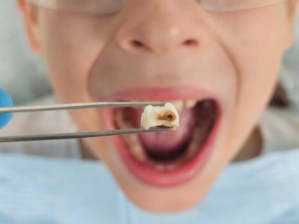 Best Broken Tooth Emergency  in Wolfforth, TX